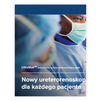 LithoVue