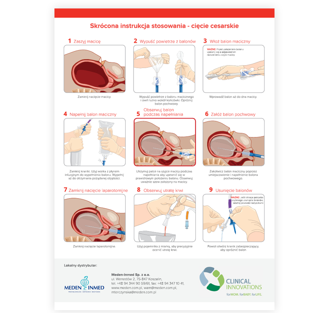 Ulotka EBB System Tamponady Poporodowej - Skrócona Instrukcja - A4 2019 - obrazek 2