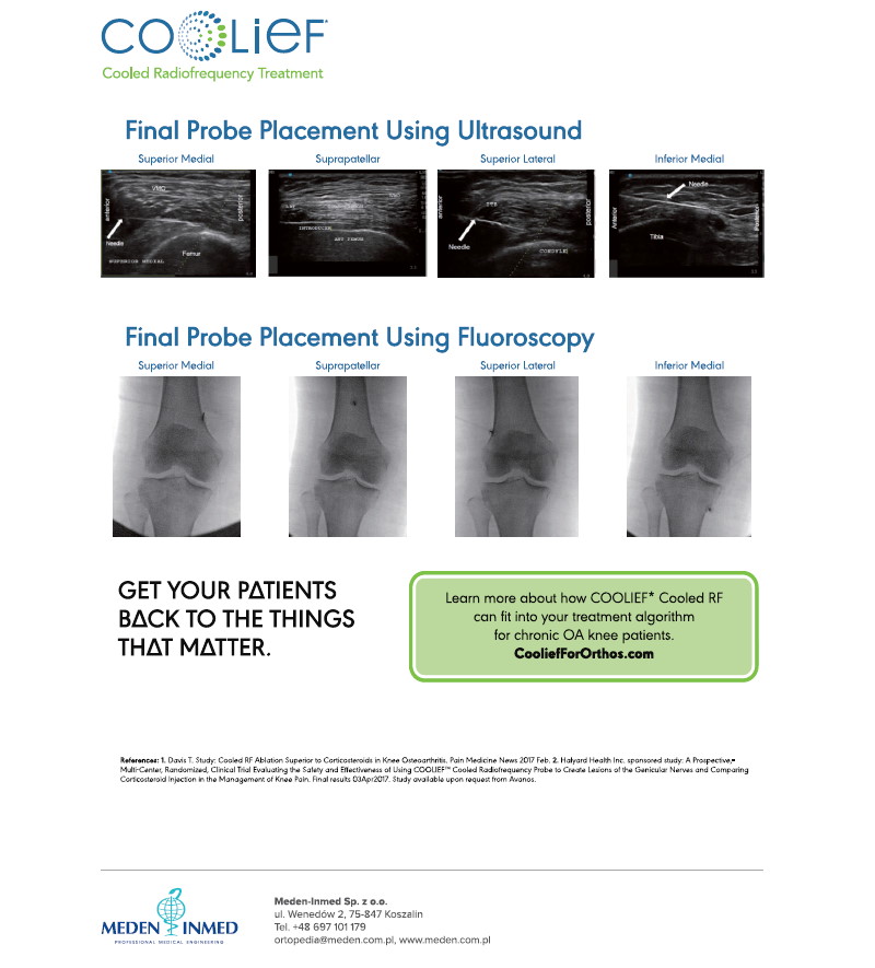 Ulotka Coolief Ultrasound and Fluoroscopic - Guided Knee Techniques Overview Avanos EN - 2xA4 2021 - obrazek 4